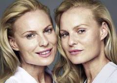 Twins